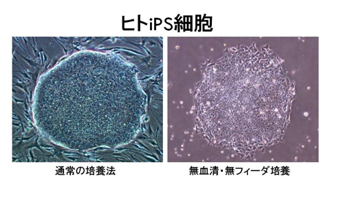 図１ ラチェット型のマイクロチャンバー内の神経様の細胞（左）とその運動解析（右）