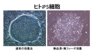 図１ ラチェット型のマイクロチャンバー内の神経様の細胞
（左）とその運動解析（右）