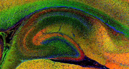 図２ マウス脳の記憶に関わる「海馬」と呼ばれる部分を、細胞接着分子（緑色）およびシナプス分子（赤色）を検出する抗体を用いて蛍光染色した。青色は核染色。部分的に緑と赤が重なって黄色に見えることから、細胞接着分子がシナプスに局在していることがわかる。