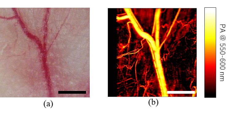 光音響顕微鏡で観察したマウスの耳の血管分布 (Hirasawa et al, J. Biomed. Opt., 29(S1), S11527, 2024)